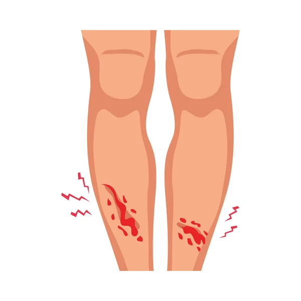 人类腿上流血的伤口扁平的病媒图解 — 图库矢量图片