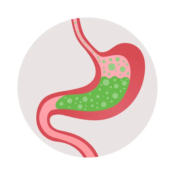 Gastrite Symtôme Nausées Vomissements Icône Plate Avec Image Vecteur Estomac — Image vectorielle
