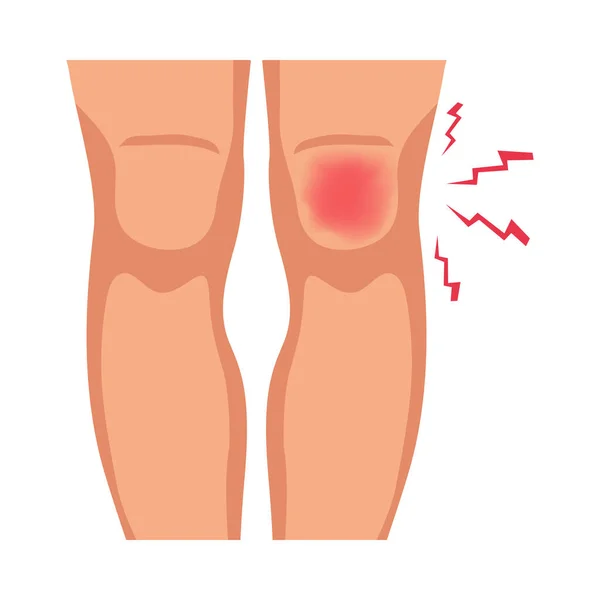 Επώδυνο Τραύμα Στο Γόνατο Ανθρώπινο Πόδι Επίπεδη Διανυσματική Απεικόνιση — Διανυσματικό Αρχείο