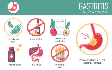 Gastrit nedenleri ve önleme sembolleri vektör illüstrasyonuna sahip GERD düz bilgi grafikleri