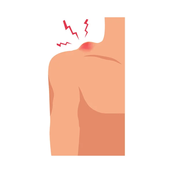 肩の領域フラットベクトルイラストの痛みを伴う傷害傷 — ストックベクタ