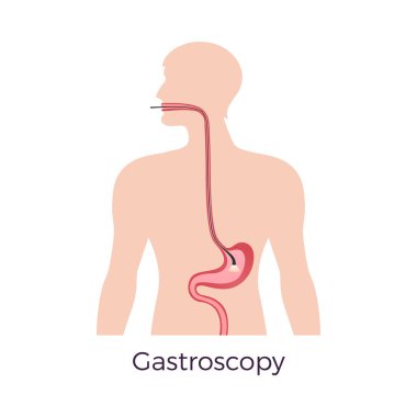 Gastroskopi incelemesi düz konsept vektör çizimi