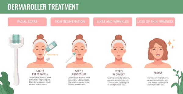 Kosmetologie Verfahren Flache Cartoon Infografik Mit Dermaroller Behandlungsvektorillustration — Stockvektor