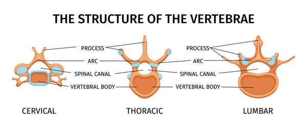 Composición Anatomía Estructura Columna Vertebral Con Imágenes Aisladas Para Vértebras — Vector de stock