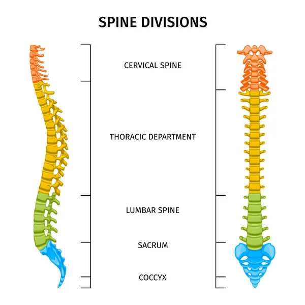脊椎分裂による脊椎構造解剖学組成図 編集可能なテキストキャプションと脊椎ベクターイラストの着色画像 — ストックベクタ