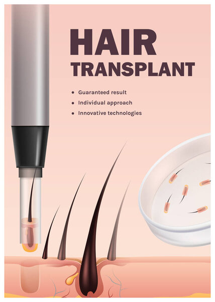 Realistic hair transplantation vertical banner template