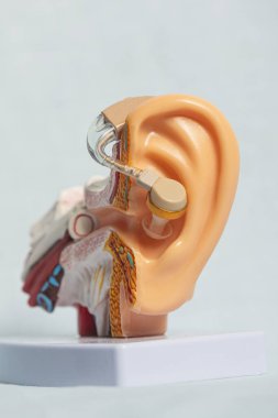 Bir kulağın anatomik modeline yerleştirilen işitme cihazının yakın çekimi, yenilikçi işitme çözümlerini vurgular