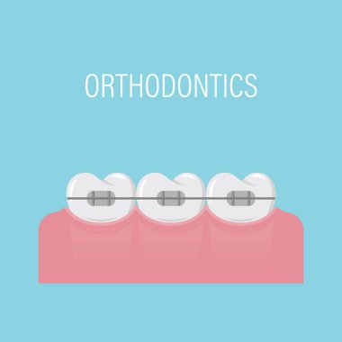 Dişlerin diş telleriyle hizalanması. Diş teli takılı bir poster. Arka arkaya sade, sağlıklı dişler. Ortodontik tedavi. İzole vektör çizimi. Düz biçim.