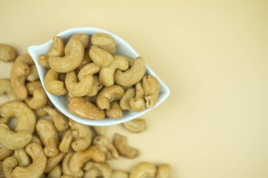 Fotokopi alanı olan bir kasede tam üzerinde kaju var.