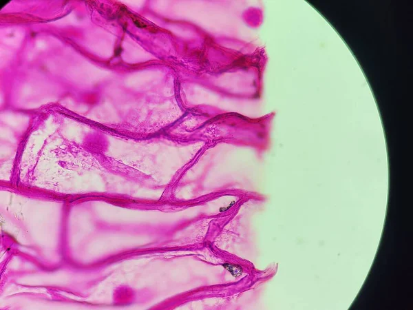 Onion skin - under microscope with pink stain