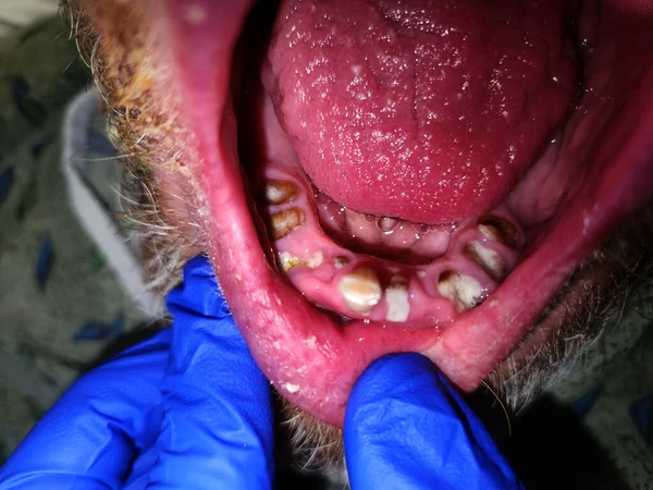 Multiple severely broken, carious mandibular teeth