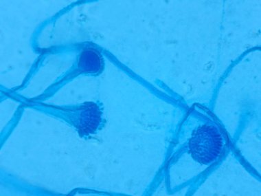 Aspergillus conidiophores - lactophenol cotton blue