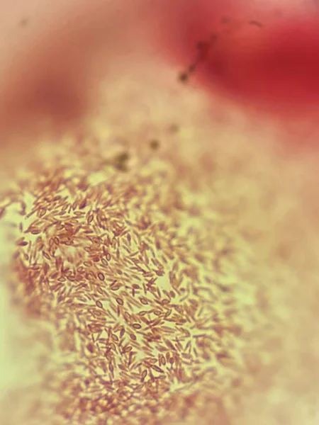 Bacillus Spore Formando Batteri Vista Microscopica — Foto Stock