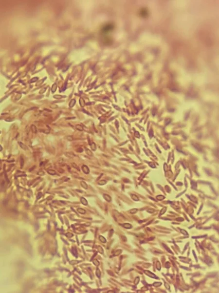 Бактерії Бактерії Мікроскопічний Погляд — стокове фото