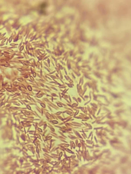 Bacillus Esporas Que Forman Bacterias Vista Microscópica —  Fotos de Stock