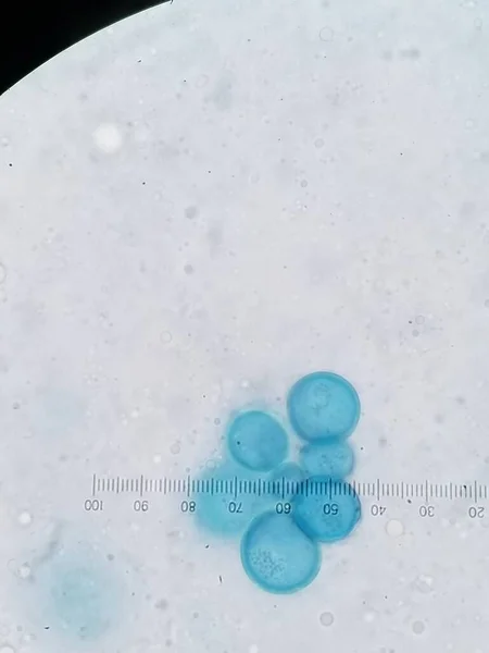 可可糖酰亚胺性结肠炎小球和胚泡染色蓝色 — 图库照片