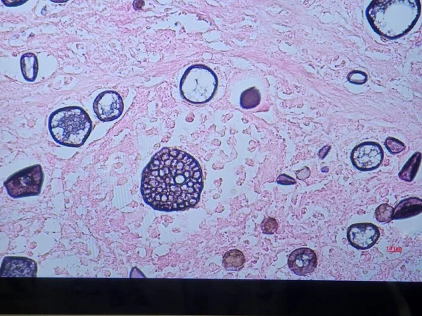 组织银染色上的可可糖酰亚胺 小球和胚泡 — 图库照片