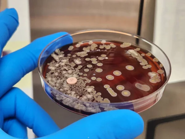 Acinetobacter bacterial colonies on agar plate - antimicrobial resistant