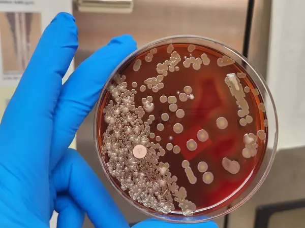 Aguar plaka üzerinde asinetobacter bakteri kolonileri - antimikrobik direnç