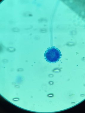 Aspergillus mantarı - laktofenol mavisi lekeli conidia ve phialides içeren vesical.