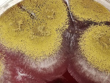 Laboratuvarda mantar kültürü medyasında büyüyen Aspergillus