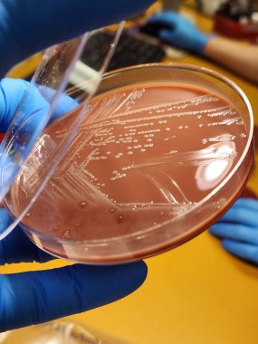 Gram lekesinde hemofili bakterisi.