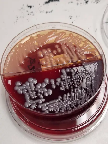 Klebsiella bacteria petri dish - blood and Macconkey agar