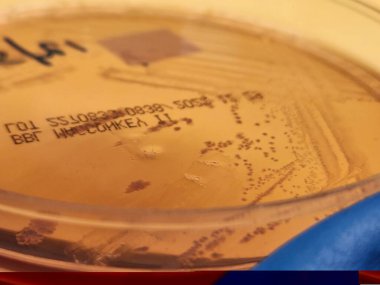 Shigella flexneri kolonileri ile petri kabı