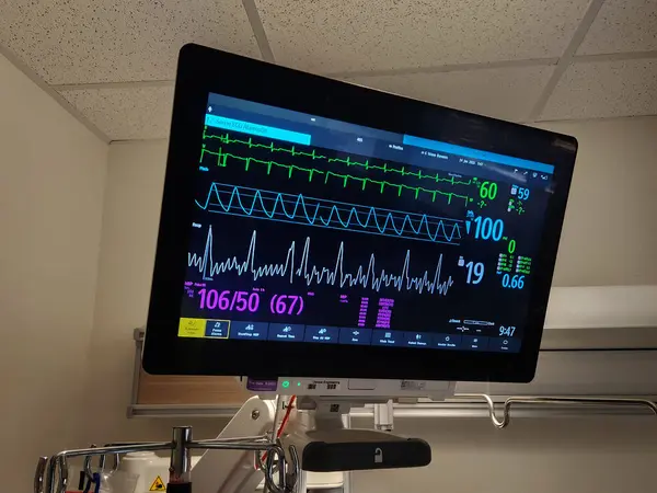 stock image EKG, Pulse, BP and Respiration ICU Monitoring Screen