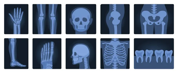 人体セット 放射線撮影と解剖学ベクトルイラストのX線フィルム 骨格の骨のシルエットと漫画の隔離された医療用のRoentgenスキャン 関節や足や手の関節炎 — ストックベクタ