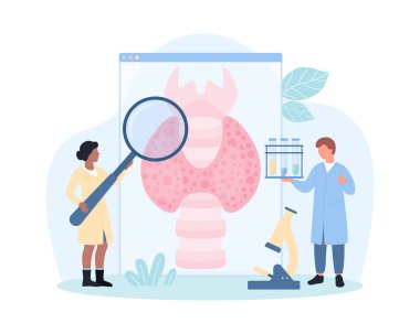 Tiroit hastalığı taşıyıcı illüstrasyonunun teşhisi. Karikatür küçük doktorlar büyüteçle ve tıbbi numunelerle test tüpü ile tiroit bezli bilgi posteri, endokrin sistem organı analiz ediyorlar.