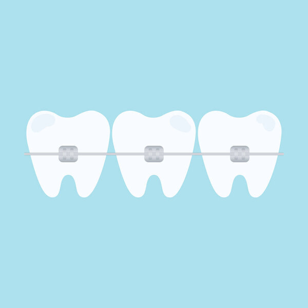 Teeth with braces. Dental braces. Orthodontic dentistry. Vector illustration 