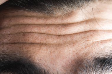 Genç adamın alın kırışıklıkları.