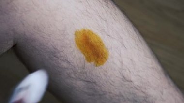 Bir adam yaralı bir bacağı iyotla tedavi eder ve elastik bandaj uygular. Tıbbi konular. Yakın plan..