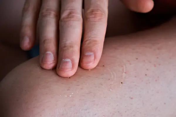 Man Applies Inflammatory Healing Cream His Leg His Hand Treatment — Stock Photo, Image
