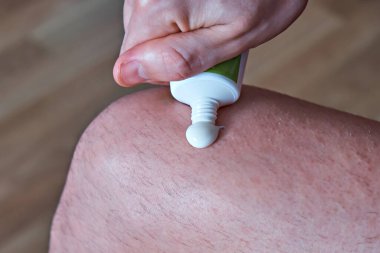 A man squeezes anti-inflammatory cream from a tube onto his leg. Treatment of arthrosis and arthritis, anti-inflammatory ointment for the treatment of joints, close-up clipart