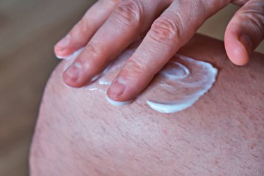 A man applies an anti-inflammatory healing cream to his leg with his hand. Treatment of arthrosis and arthritis, anti-inflammatory ointment for the treatment of joints, close-up clipart