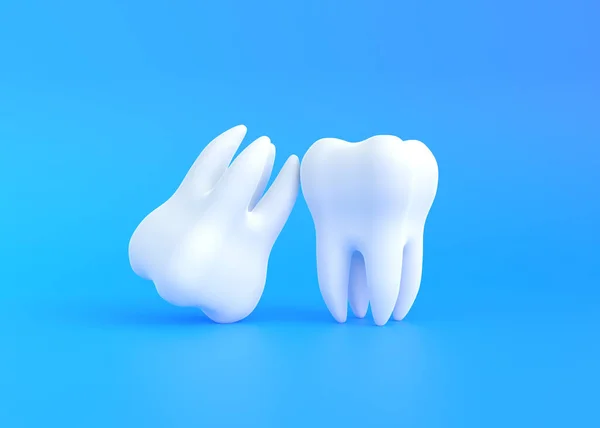 Dua Gigi Putih Dengan Latar Belakang Biru Konsep Pemeriksaan Gigi — Stok Foto
