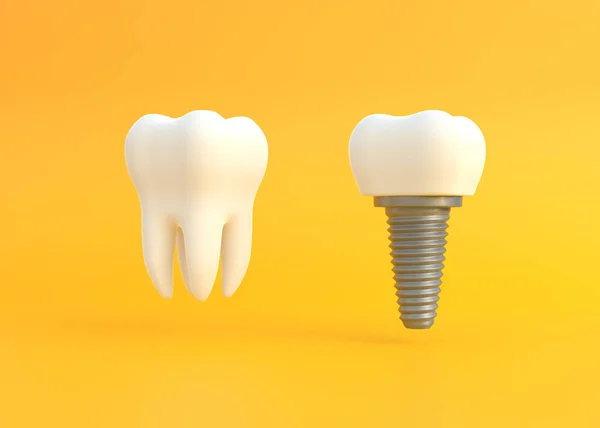 White tooth and dental implant on a yellow background. Concept of dental examination teeth, dental health and hygiene. 3d render illustration