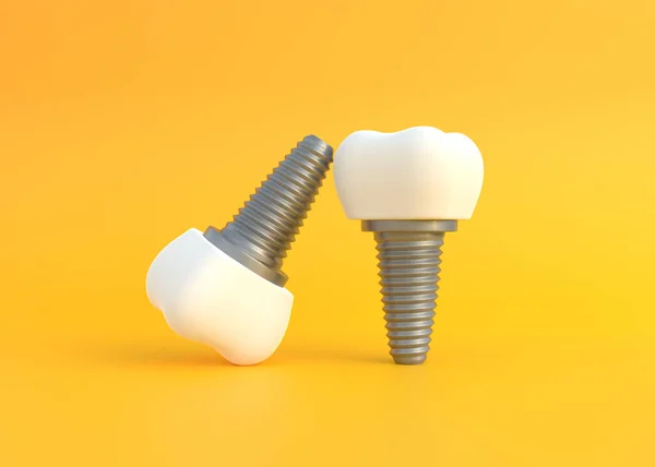 Sarı arka planda diş implantları. Diş muayenesi, diş sağlığı ve hijyen kavramı. 3d resimleme