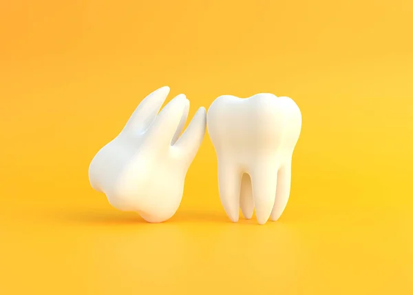 Zwei Weiße Zähne Auf Gelbem Hintergrund Konzept Der Zahnärztlichen Untersuchung — Stockfoto