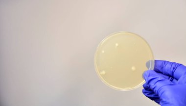 Laboratuvar ekipmanları, test tüpleri, kimyasal ve ilaç konsepti 