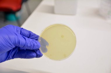 Laboratuvar ekipmanları, test tüpleri, kimyasal ve ilaç konsepti 