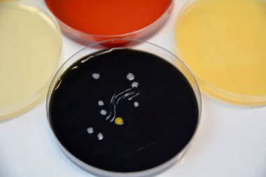 Laboratuvar ekipmanları, test tüpleri, kimyasal ve ilaç konsepti 