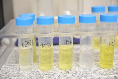 Laboratuvar ekipmanları, test tüpleri, kimyasal ve ilaç konsepti 