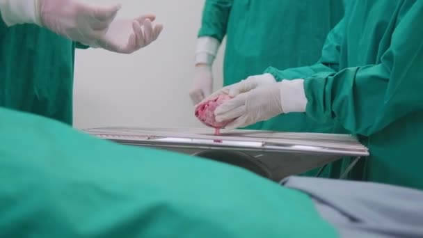Artsen Geven Het Hart Aan Gespecialiseerde Chirurgen Voor Verandering Medische — Stockvideo