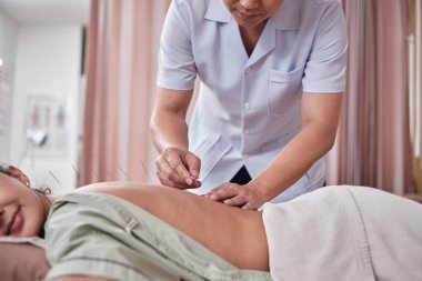 Asyalı erkek fizyoterapist, hastayı akupunktur tedavisiyle iyileştirir. Ağrı kesici, geleneksel oryantal el prosedürü, hastane kliniğindeki sağlık merkezinde pasif tıbbi tedavi..