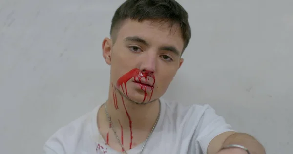 The guys face after a street fight. He sits on a light background with a broken nose, wipes the blood with his hand. Stress after a blow to the face.