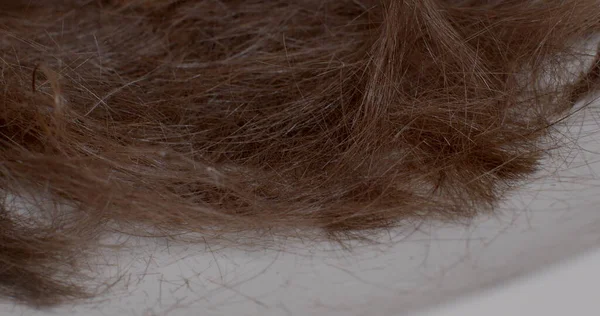Cropped Hair Person Infested Lice Nits Parasite Shedding Hair Health Fotos De Bancos De Imagens