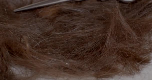 Bitlerle Parazitlerle Istila Edilmiş Bir Insanın Kırpılmış Saçı Sağlık Nedenlerinden — Stok video